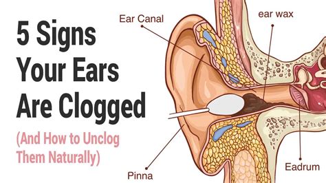 natural ways    ears drain  drain  primagemorg