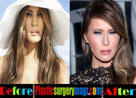 melania trump before and after photos ociotube