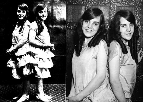 discovery  iq scores  conjoined twins daisy  violet hilton russell  warne