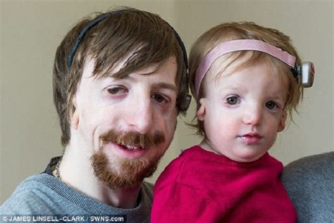 cruel bullies call father and daughter with facial deformity ugly say he should have aborted