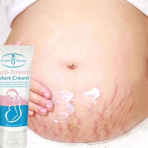 Stretch Mark Remover Peklat Remover For Legs Anti Stretch Mark For