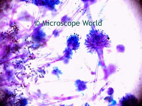 microscope world blog mold   microscope