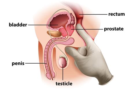 male prostate g spot 6 pics xhamster