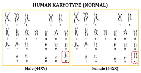 Karyotype Analysis Of Human Chromosome Easybiologyclass Chromosome