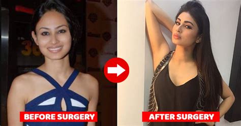 10 Tv Actresses Who Ve Undergone Plastic Surgery Rvcj Media