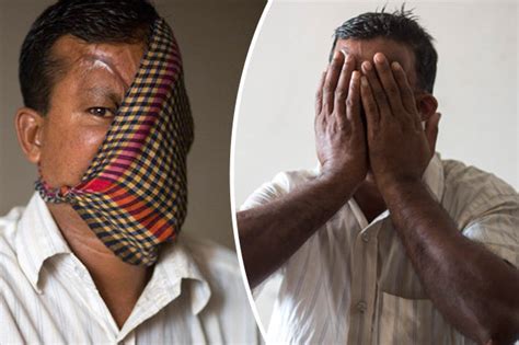 hashmot ali man left with no face after savage tiger attack daily star