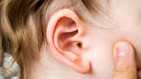 baby   ear infection   baby younger  age    doctor