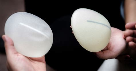 are breast implants making people sick