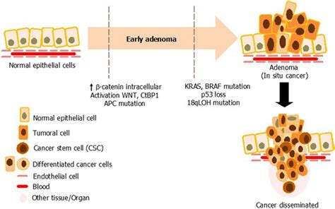 Carcinogenesis Of Colon Cancer Progression Of Colon Normal Epithelium