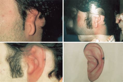 left microtic ear    ear   printed  scientific