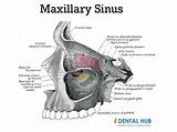 Sinus Maxillary Sinuses Bone Paranasal Neuroanatomy Anatomie Problems sketch template