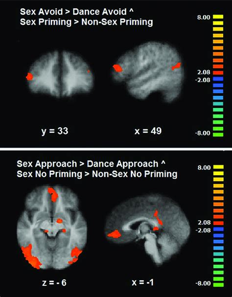 Conjunction Of Motivational And Cognitive Sexual Inhibition Common