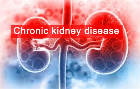 family history  kidney disease strongly linked  increased ckd risk