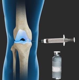 gel injections worcester ma knee pain knee osteoarthritis manchester ma