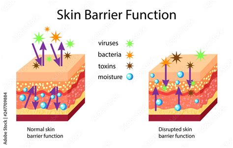 skin barrier function normal  disrupted vector illustration stock