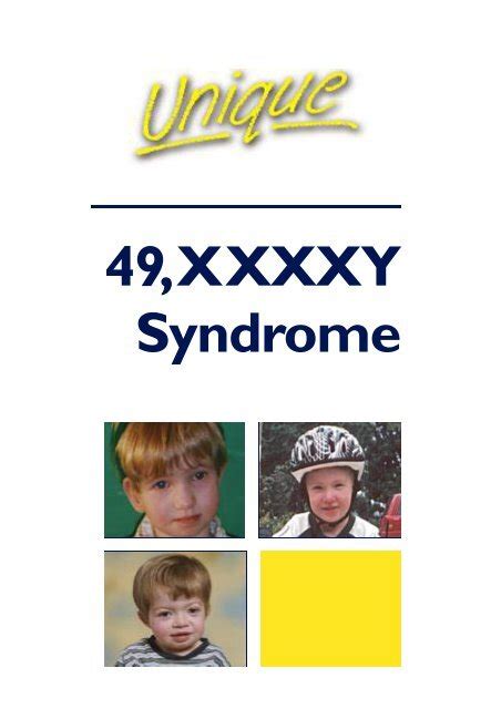 49 Xxxxy Syndrome Unique The Rare Chromosome Disorder