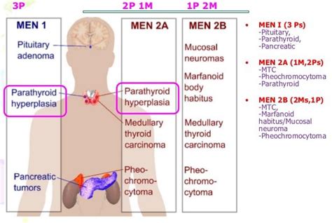 men syndrome mnemonics epomedicine