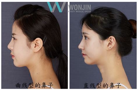 Korean Plastic Surgery That The Chinese Must Be Aware Of 2