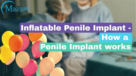 Inflatable Penile Implant How A Penile Implant Works Youtube