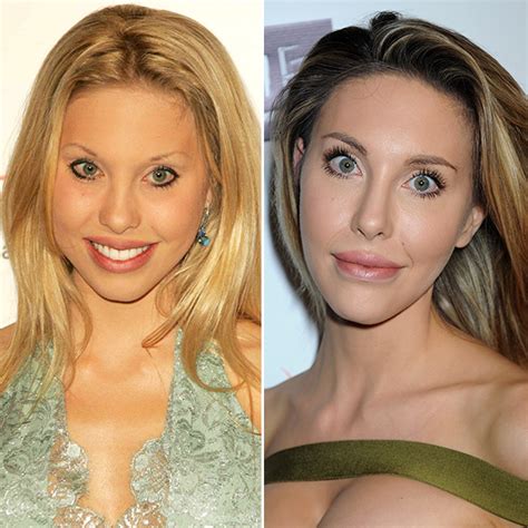 [pics] Chloe Lattanzi’s Plastic Surgery Before And After Pics