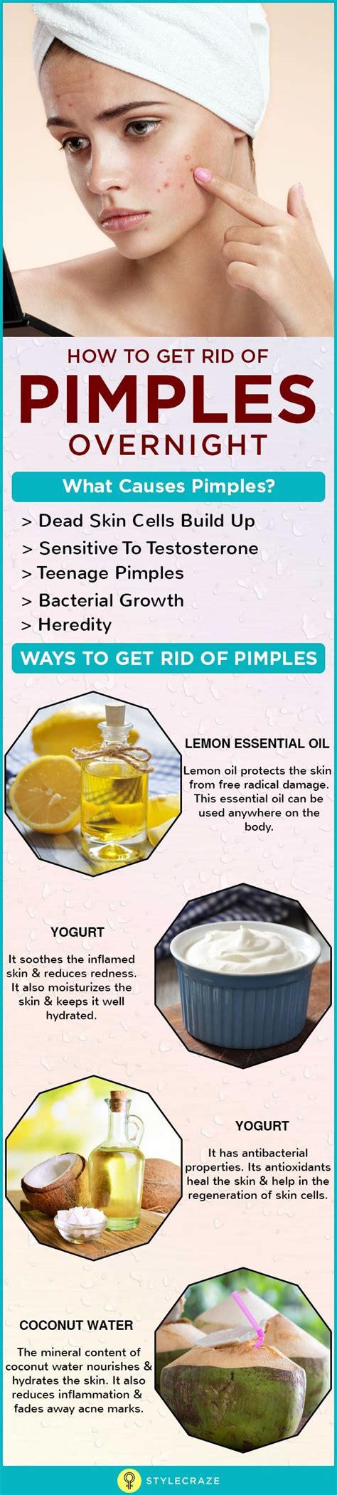 how to get rid of pimples acne overnight fast are pimples