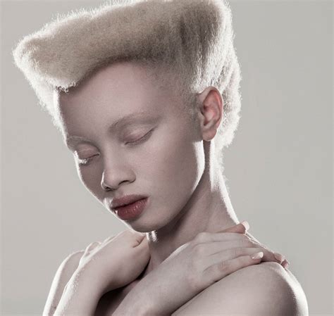 Albinism Photographed Beauty In Breaking Convention South African
