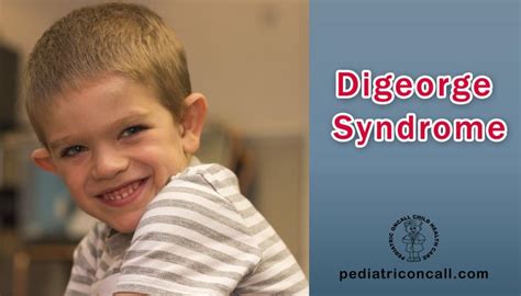 digeorge syndrome  symptoms  digeorge syndrome digeorge