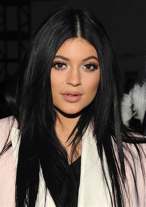 [pics] Kylie Jenner’s Plastic Surgery — Has The 17 Year