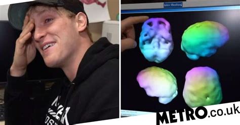 Logan Paul Reveals He Has Brain Damage That Causes Lack Of Empathy