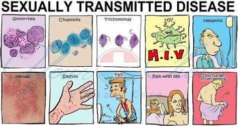 30 Best Sexually Transmitted Diseases Images On Pinterest