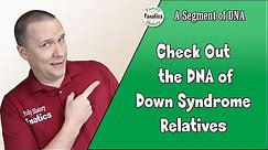 A Chromosome Look at Trisomy (Down Syndrome) - | Genetics Explained