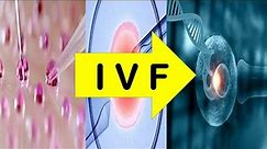 In-Vitro-Fertilization (IVF) Process