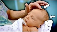 THIS NEWBORN HAS 2 HOLES IN HIS SKULL! (Fontanelle) | Dr. Paul