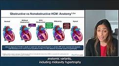 Making Strides in Hypertrophic Cardiomyopathy: Guidelines, Science, and Strategies