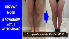 Krzywe nogi - 8 powodów aby je wyprostować | OMP#056