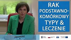 Rak podstawnokomórkowy - typy i leczenie - Prof. dr hab. n. med. Agnieszka Żebrowska