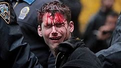 Bloody Occupy Wall Street Arrest