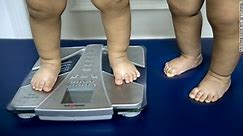 Should parents be punished for obese kids?