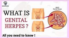 Herpes (Genital) - causes, symptoms, treatment, pathology | Herpes simplex virus