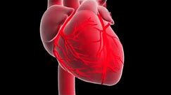 What is a myocardial infarction or heart attack ?