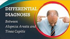 Differential Diagnosis Between Alopecia Areata and Tinea Capitis | Alopecia Areata Treatment |