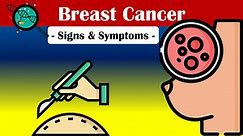Warning Signs Of A Breast Cancer |What Are The Early Signs Of Breast Cancer?