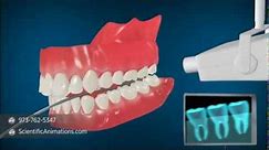 Medical Animation explaining Dental Radiography | Dental X-Rays