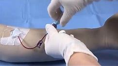 BD Nexiva™ Diffusics™ Closed IV Catheter Insertion Techniques
