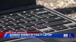 Massachusetts student burned by faulty laptop during MCAS