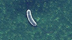 Flesh-eating bacteria seen in Delaware Bay