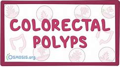 Colorectal polyps - an Osmosis Preview