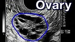 In-Vitro Fertilization (IVF) 101 (Pregnancy Health Guru)