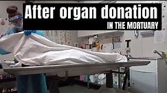 In the mortuary: after organ donation