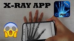 X-Ray App